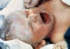 1978 год. Луиз Браун, первый в мире «ребенок из пробирки»..jpg